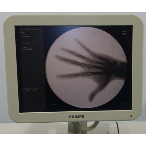 PHILIPS Veradius C-Arm - Image 3