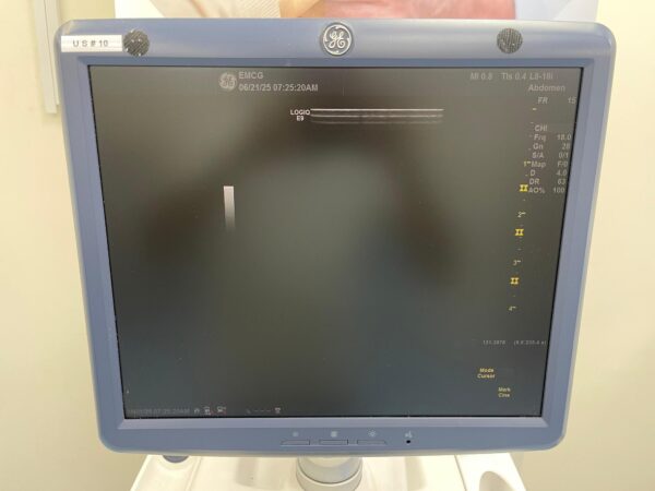 GE LOGIQ E9 - Image 10