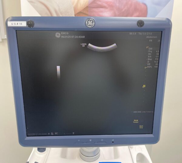 GE LOGIQ E9 - Image 11