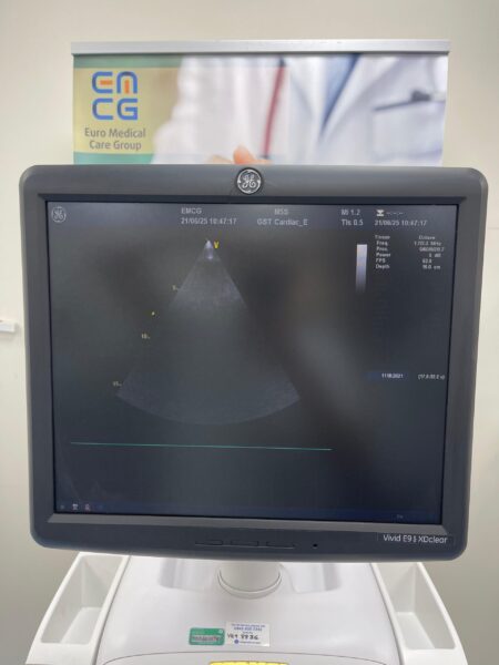 GE Vivid E9 XDClear - Image 10