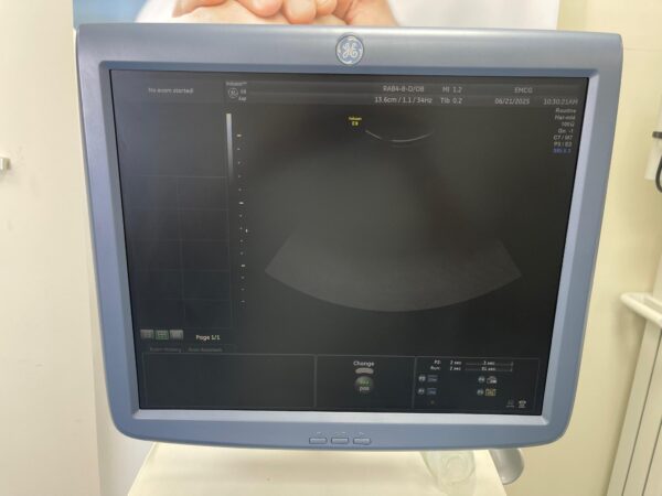 GE Voluson E8 - Image 11