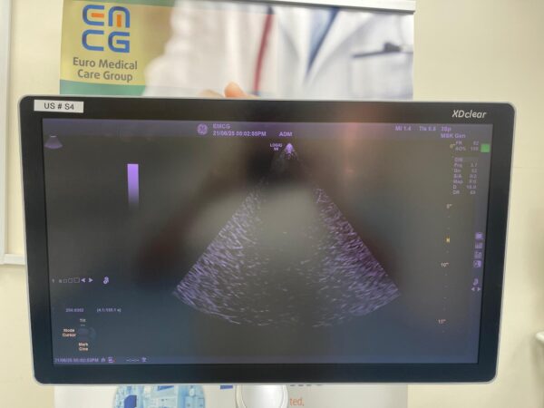 GE LOGIQ S8 XDclear - Image 7