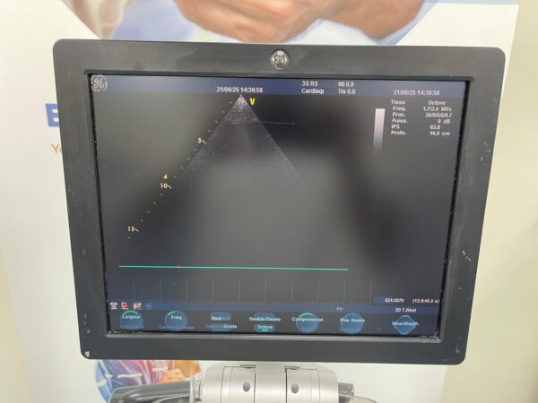 GE Vivid S5 - Image 7