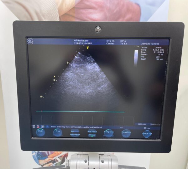 GE Vivid S6 - Image 8