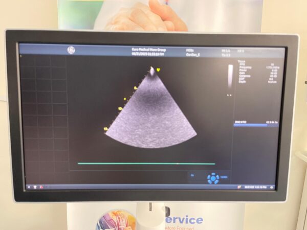 GE Vivid S70N - Image 8